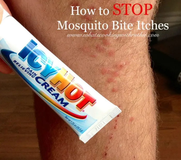 How to STOP Mosquito Bite Itches by www.whatscookingwithruthie.com